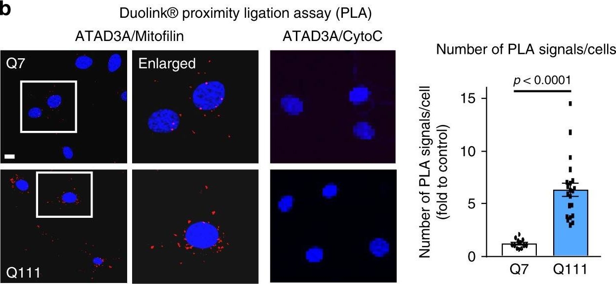 Fig.2.B showing Immunocytochemistry in a Mus musculus (House mouse) sample from the publication: ATAD3A oligomerization causes neurodegeneration by coupling mitochondrial fragmentation and bioenergetics defects.