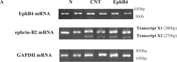 Fig.4.A showing Western Blotting in a Mus musculus (House mouse) sample from the publication: Targeting the Eph/Ephrin System as Anti-Inflammatory Strategy in IBD.