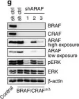 Fig.6.G showing Western Blotting from the publication: RAF proteins exert both specific and compensatory functions during tumour progression of NRAS-driven melanoma.
