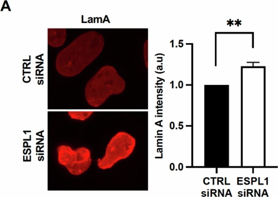 Fig.5.P showing Immunocytochemistry-immunofluorescence in a Homo sapiens (Human) sample from the publication: An evolutionarily conserved role for separase in the regulation of nuclear lamins.