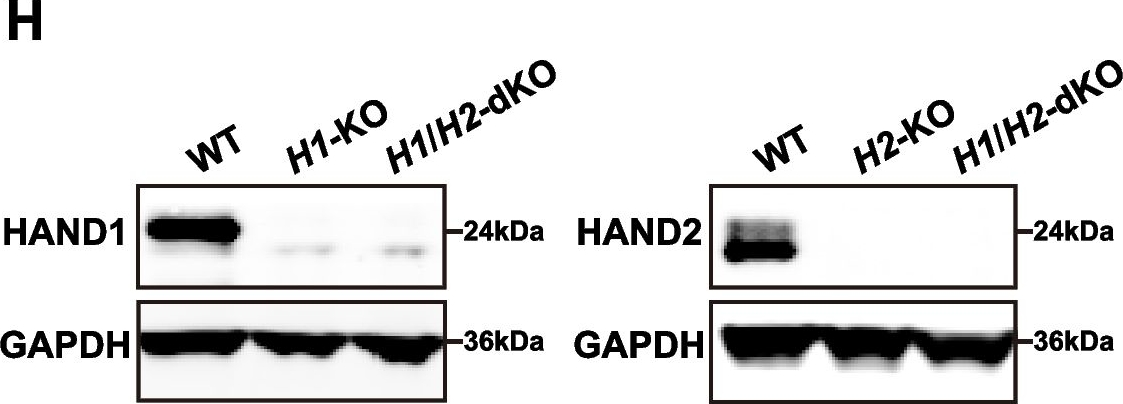 Fig.1.H showing Western Blotting from the publication: HAND factors regulate cardiac lineage commitment and differentiation from human pluripotent stem cells.
