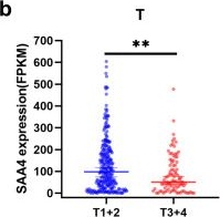 Fig.2.B showing Flow cytometry/Cell sorting in a Homo sapiens (Human) sample from the publication: Low SAA4 gene expression is associated with advanced HCC stage and a poor prognosis.