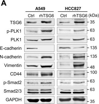Fig.4.A showing Western Blotting in a Homo sapiens (Human) sample from the publication: TSG6 promotes epithelial-mesenchymal transition and tumor-associated macrophage polarization through Smad2/3 and MAPK signaling by facilitating TSG6-CD44-TGFβR1 or EGFR complex formation.