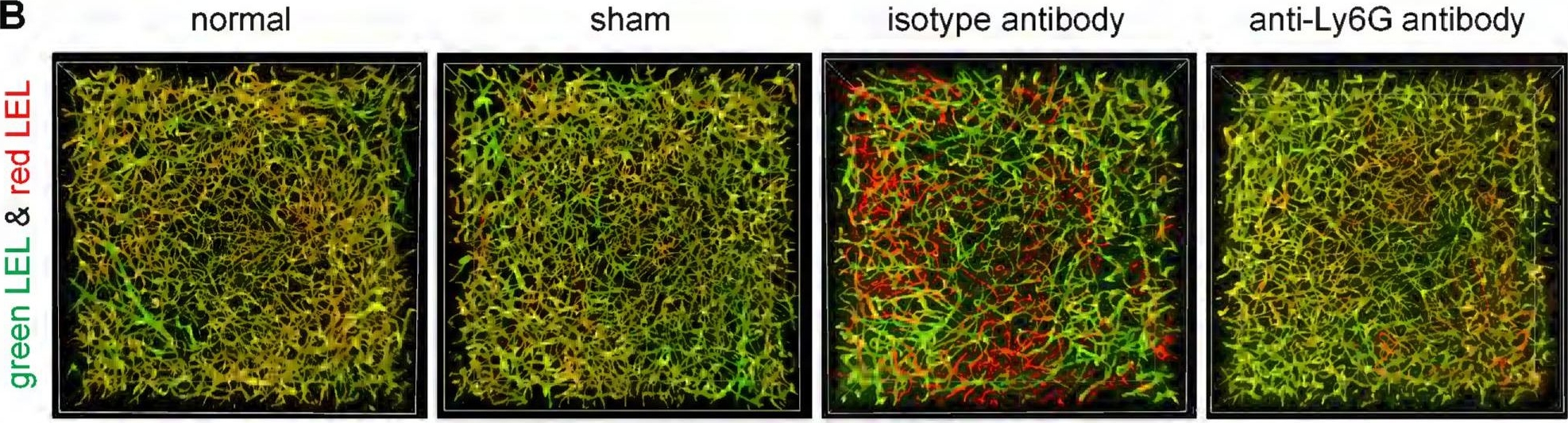 Fig.5.B showing Immunohistochemistry-immunofluorescence in a Mus musculus (House mouse) sample from the publication: A labeling strategy for the three-dimensional recognition and analysis of microvascular obstruction in ischemic stroke.
