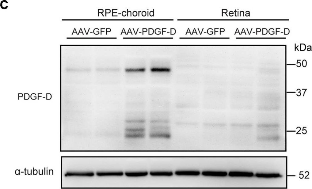 Fig.2.C showing Western Blotting in a Mus musculus (House mouse) sample from the publication: Platelet-Derived Growth Factor-D Activates Complement System to Propagate Macrophage Polarization and Neovascularization.