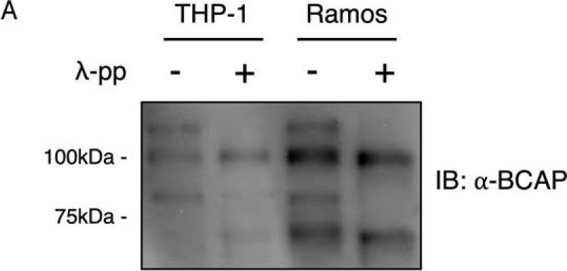 Fig.1.A showing Western Blotting in a Homo sapiens (Human) sample from the publication: Phosphorylation of the multifunctional signal transducer B-cell adaptor protein (BCAP) promotes recruitment of multiple SH2/SH3 proteins including GRB2.