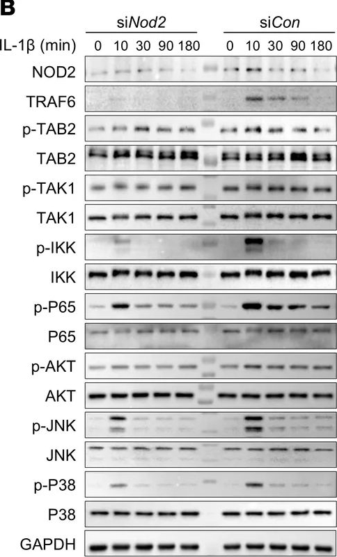 Fig.7.B showing Western Blotting from the publication: Innate immune sensor NOD2 promotes cartilage degradation and osteoarthritis progression by stabilizing TRAF6 in chondrocytes.