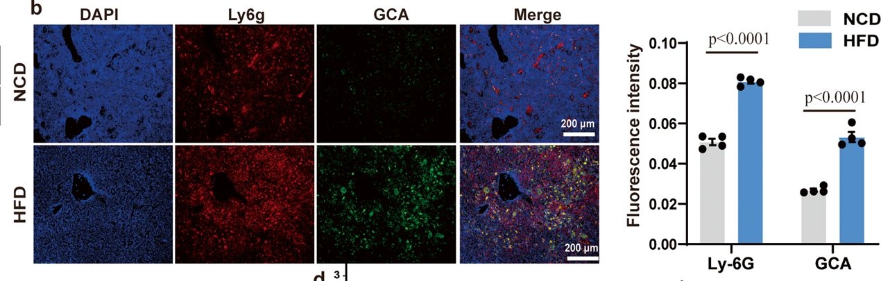 Fig.1.B showing Immunohistochemistry-immunofluorescence in a Mus musculus (House mouse) sample from the publication: Myeloid-derived grancalcin instigates obesity-induced insulin resistance and metabolic inflammation in male mice.