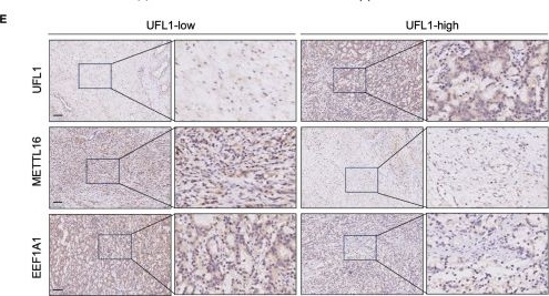 Fig.8.E showing Immunohistochemistry from the publication: Loss of UFL1 confers enzalutamide resistance of prostate tumors by regulating METTL16-mediated m6A modification of EEF1A1 mRNA.