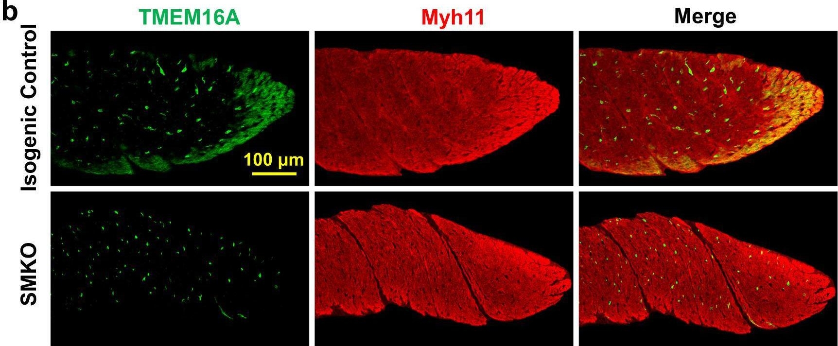 Fig.5.B showing Immunohistochemistry-immunofluorescence in a Mus musculus (House mouse) sample from the publication: TMEM16A in smooth muscle cells acts as a pacemaker channel in the internal anal sphincter.