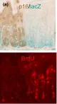 Fig.2.A showing Immunohistochemistry in a Mus musculus (House mouse) sample from the publication: Reversible cell cycle inhibition and premature aging features imposed by conditional expression of p16Ink4a.
