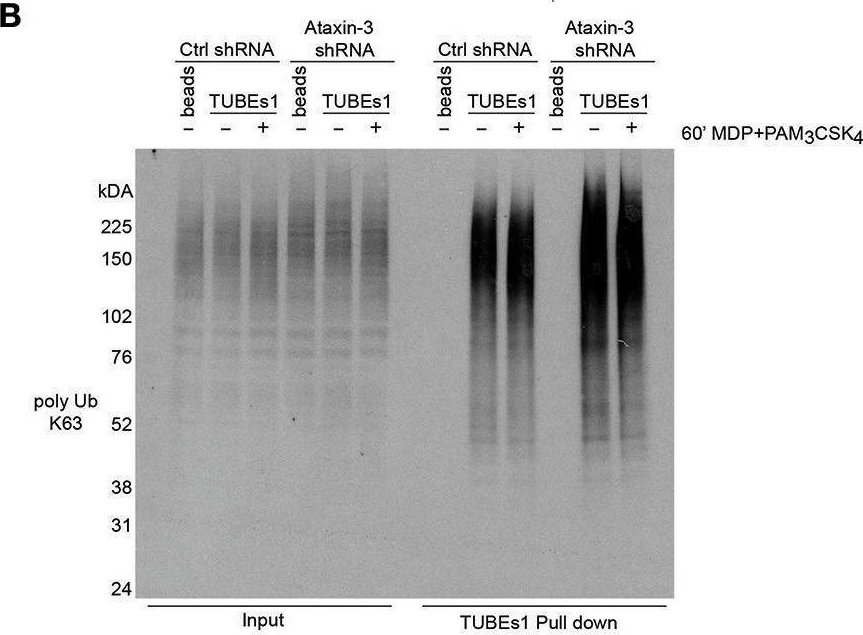 Fig.5.B showing Western Blotting from the publication: Ataxin-3 Links NOD2 and TLR2 Mediated Innate Immune Sensing and Metabolism in Myeloid Cells.