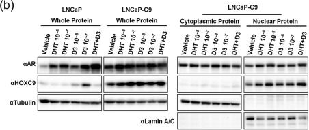 Fig.4.B showing Western Blotting in a Homo sapiens (Human) sample from the publication: Androgen Signaling Represses Homeobox C9, an Inhibitor of Androgen Receptor, in Prostate Cancer Cells.