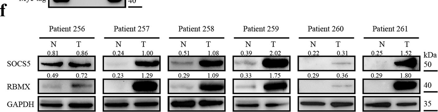 Fig.3.F showing Western Blotting from the publication: SOCS5-RBMX stimulates SREBP1-mediated lipogenesis to promote metastasis in steatotic HCC with HBV-related cirrhosis.