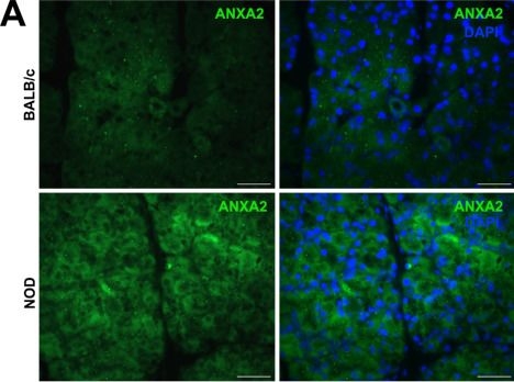 Fig.7.A showing Immunohistochemistry-immunofluorescence in a Mus musculus (House mouse) sample from the publication: Quantitative Changes in the Proteome of Chronically Inflamed Lacrimal Glands From a Sjögren's Disease Animal Model.