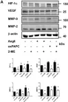 Fig.3.A showing Western Blotting from the publication: Inhibition of hypoxia inducible factor-1α attenuates abdominal aortic aneurysm progression through the down-regulation of matrix metalloproteinases.