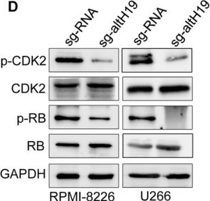 Fig.7.D showing Western Blotting in a Homo sapiens (Human) sample from the publication: LncRNA H19-Encoded Micropeptide altH19 Promotes DNA Replication and Mitosis in Myeloma Cells by Enhancing the Phosphorylation of CDK2 at Threonine 160.