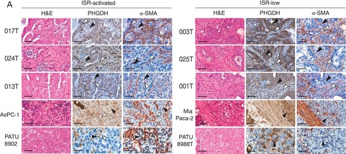 Fig.7.A showing Immunohistochemistry from the publication: Decoding the Integrated Stress Response of Pancreatic Cancer: Identifying a Serine-dependent Tumor Subset Under Metabolic Relationships With CAFs.