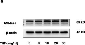 Fig.1.A showing Western Blotting in a Homo sapiens (Human) sample from the publication: The Acid Sphingomyelinase Inhibitor Amitriptyline Ameliorates TNF-α-Induced Endothelial Dysfunction.