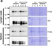 Fig.6.A showing Western Blotting from the publication: PKN1 kinase-negative knock-in mice develop splenomegaly and leukopenia at advanced age without obvious autoimmune-like phenotypes.