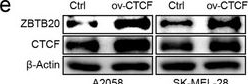 Fig.4.E showing Western Blotting from the publication: Dysregulation of the PATZ1/CTCF Balance Silences ZBTB20 to Drive Melanoma Progression.