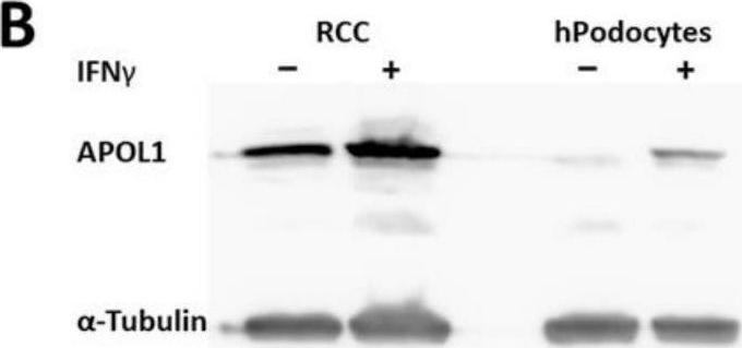 Fig.1.B showing Western Blotting from the publication: Comparative Analysis of the APOL1 Variants in the Genetic Landscape of Renal Carcinoma Cells.