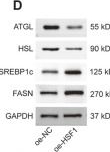Fig.8.D showing Western Blotting in a Mus musculus (House mouse) sample from the publication: HSF1 modulates lipid metabolism and ferroptosis in sarcopenia: a novel diagnostic biomarker and therapeutic target.