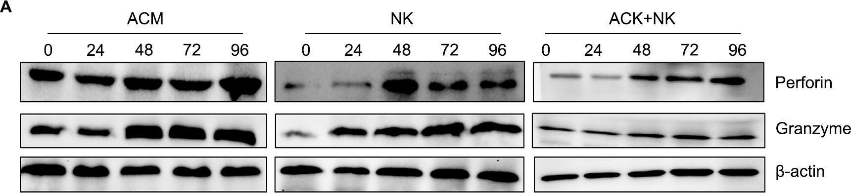 Fig.7.A showing Western Blotting in a Homo sapiens (Human) sample from the publication: Aclacinomycin enhances the killing effect of allogeneic NK cells on acute myeloid leukemia cells by inducing immunogenic cell death.