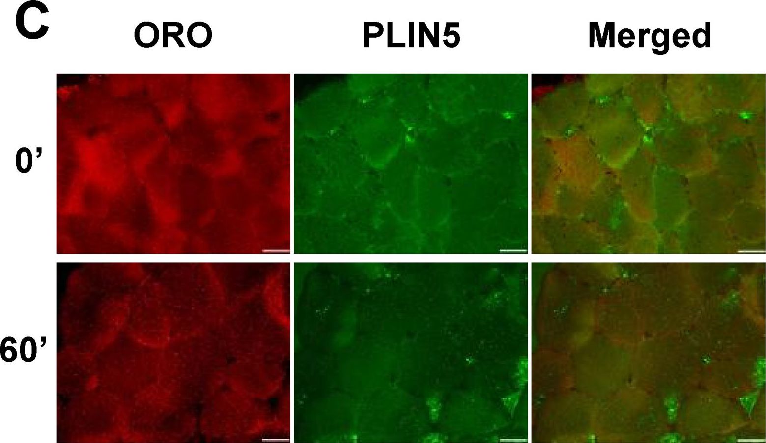 Cellular localization and associations of the major lipolytic proteins in human skeletal muscle at rest and during exercise.