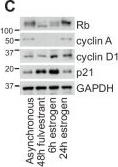 Fig.2.C showing Western Blotting from the publication: Endocrine therapy reprogramming of breast cancer facilitates metastatic escape via upregulation of P-Rex1/Rac1 signalling.