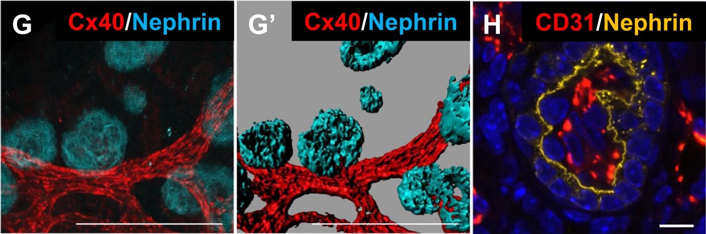 Reconstitution of the embryonic kidney identifies a donor cell contribution to the renal vasculature upon transplantation.