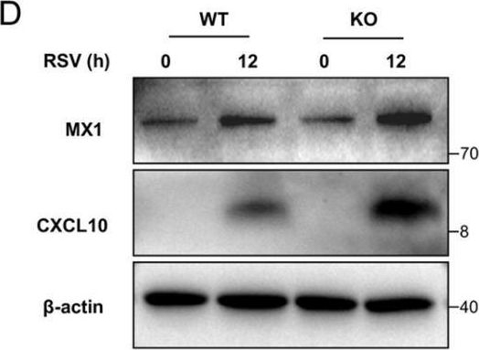Fig.4.D showing Western Blotting in a Mus musculus (House mouse) sample from the publication: RNF149 modulates the type I IFN innate antiviral immune responses through degrading IRF3.