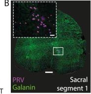 Fig.2.B showing Immunohistochemistry-immunofluorescence from the publication: A galanin-positive population of lumbar spinal cord neurons modulates sexual arousal and copulatory behavior in male mice.