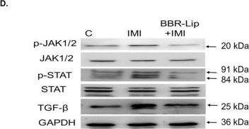 Fig.7.D showing Western Blotting in a Rattus norvegicus (Rat) sample from the publication: Imidacloprid exposure in rats induces cardiac inflammatory response through activating TLR4/NF-κB/NLRP3 and JAK/STAT signaling pathways: focus on the berberine-loaded nanoliposomes.