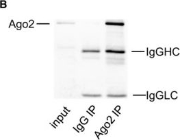 Fig.4.B showing Immunoprecipitation in a Homo sapiens (Human) sample from the publication: MiR-30c protects diabetic nephropathy by suppressing epithelial-to-mesenchymal transition in db/db mice.