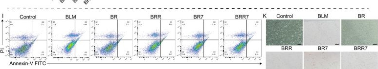 Fig.6.C showing Flow cytometry/Cell sorting in a Mus musculus (House mouse) sample from the publication: Exploring the role of RCEO in macrophage-mediated modulation of pulmonary fibrosis.