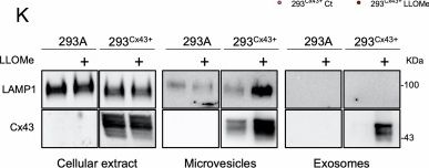 Fig.2.K showing Western Blotting from the publication: Connexin43 promotes exocytosis of damaged lysosomes through actin remodelling.