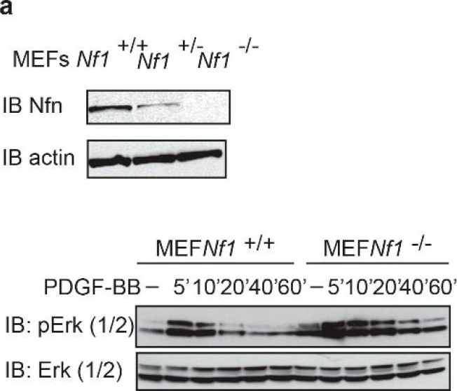 Fig.1.A showing Western Blotting in a Mus musculus (House mouse) sample from the publication: Neurofibromin Deficiency and Extracellular Matrix Cooperate to Increase Transforming Potential through FAK-Dependent Signaling.