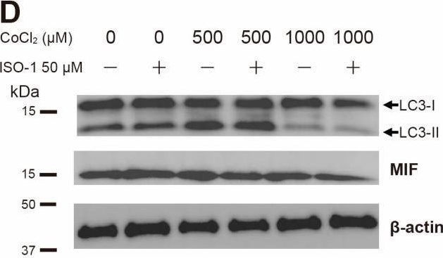 Fig.4.D showing Western Blotting from the publication: MIF Inhibition by ISO-1 Decreased Autophagic Activity in Primary Astrocytes During Cobalt Chloride-Induced Hypoxia.