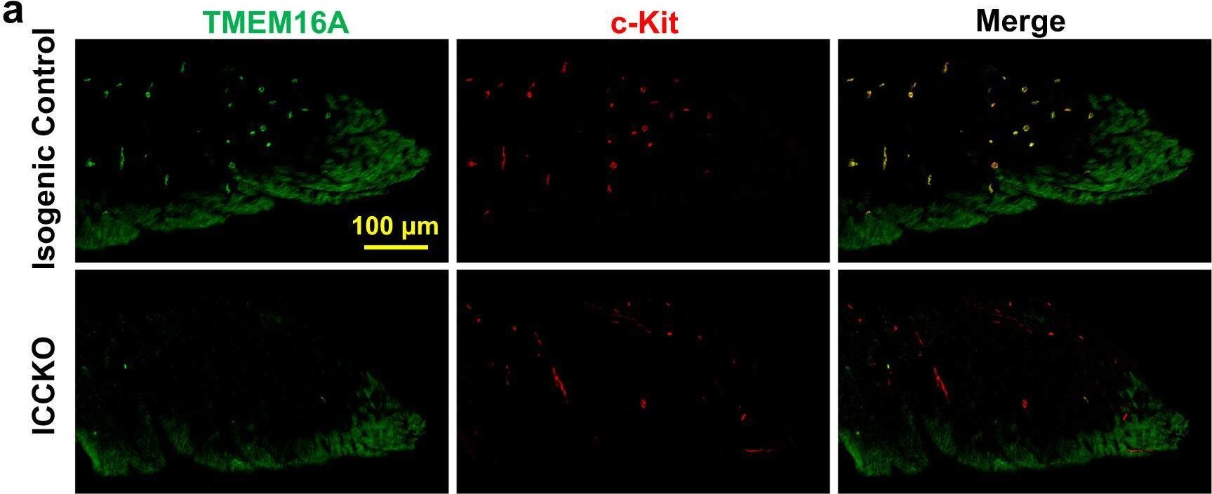 Fig.5.A showing Immunohistochemistry-immunofluorescence in a Mus musculus (House mouse) sample from the publication: TMEM16A in smooth muscle cells acts as a pacemaker channel in the internal anal sphincter.