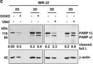Fig.3.C showing Western Blotting in a Homo sapiens (Human) sample from the publication: Three-dimensional tumor cell growth stimulates autophagic flux and recapitulates chemotherapy resistance.