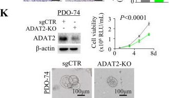 Fig.2.K showing Western Blotting in a Homo sapiens (Human) sample from the publication: ADAT2-mediated A-to-I tRNA modification promotes oncogenic translation and colorectal cancer progression and chemoresistance.