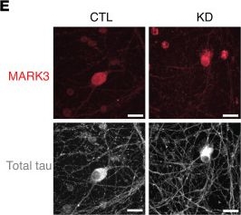 Fig.7.E showing Immunocytochemistry-immunofluorescence in a Homo sapiens (Human) sample from the publication: TDP-43 dysregulation of polyadenylation site selection is a defining feature of RNA misprocessing in amyotrophic lateral sclerosis and frontotemporal dementia.