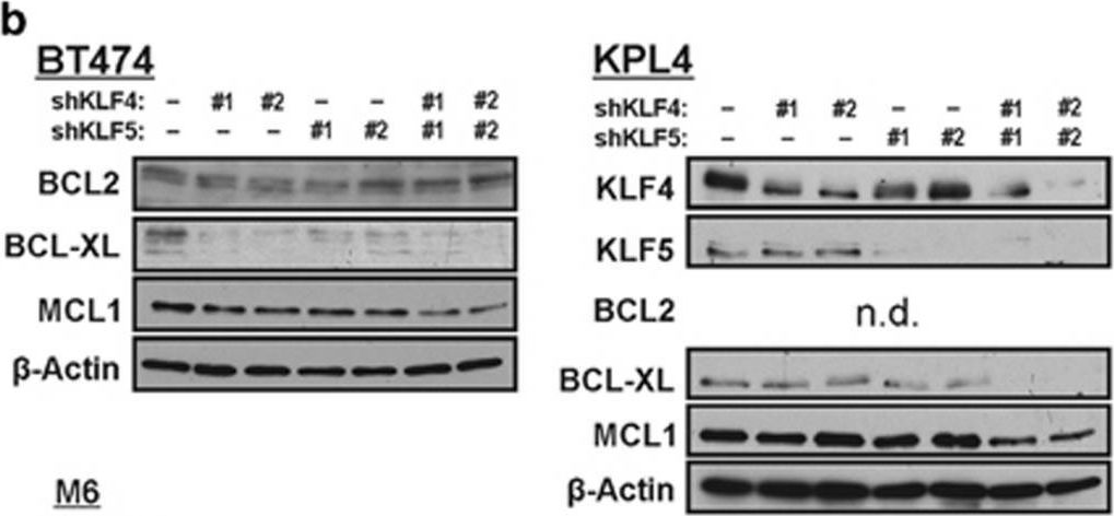 Fig.5.B showing Western Blotting from the publication: Regulation of anti-apoptotic signaling by Kruppel-like factors 4 and 5 mediates lapatinib resistance in breast cancer.