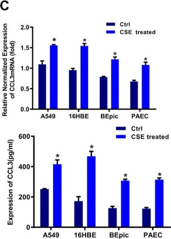 Fig.1.C showing Enzyme-linked immunosorbent assay from the publication: miR-4456/CCL3/CCR5 Pathway in the Pathogenesis of Tight Junction Impairment in Chronic Obstructive Pulmonary Disease.