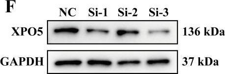 Fig.6.F showing Western Blotting in a Homo sapiens (Human) sample from the publication: Tumor-derived exosomal lncRNA SNHG4 promotes triple-negative breast cancer progression by targeting XPO5.