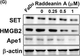 Fig.4.G showing Western Blotting in a Homo sapiens (Human) sample from the publication: Raddeanin A augments the cytotoxicity of natural killer cells against chronic myeloid leukaemia cells by modulating MAPK and Ras/Raf signalling pathways.
