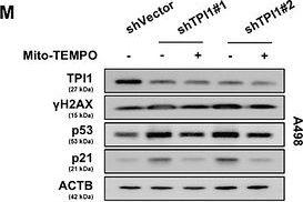 Fig.3.M showing Western Blotting from the publication: TPI1 Loss Triggers a Metabolite-Driven Mitochondrial Redox Vulnerability via the SARM1-cADPR-Ca2+ Axis.