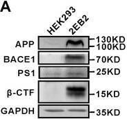Fig.2.A showing Western Blotting in a Mus musculus (House mouse) sample from the publication: KIF9 Ameliorates Neuropathology and Cognitive Dysfunction by Promoting Macroautophagy in a Mouse Model of Alzheimer's Disease.