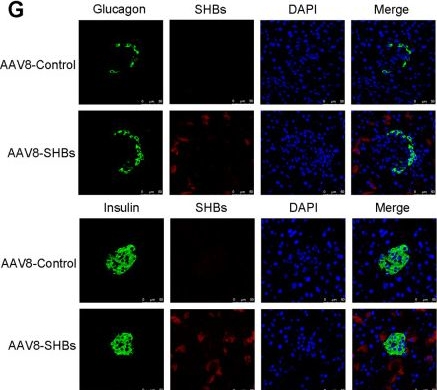 Fig.2.G showing Immunocytochemistry-immunofluorescence in a Mus musculus (House mouse) sample from the publication: Small Hepatitis B Virus Surface Antigen Promotes Hepatic Gluconeogenesis via Enhancing Glucagon/cAMP/Protein Kinase A/CREB Signaling.